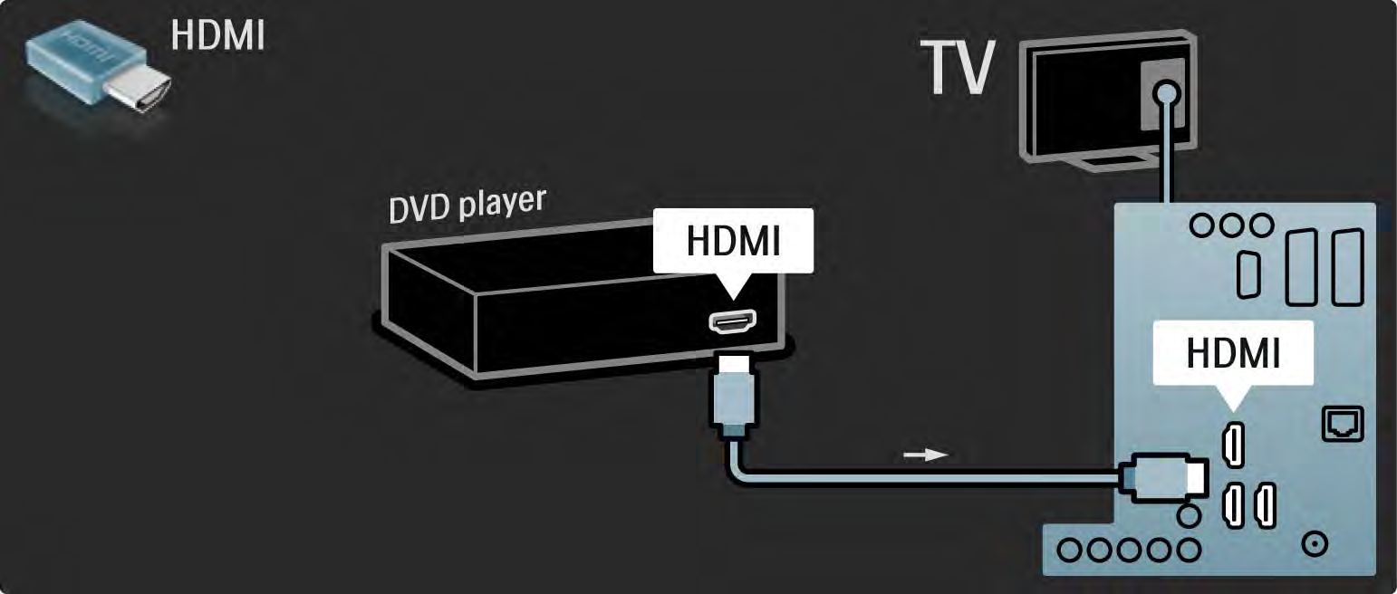 5.3.1 DVD-lejátszó Használjon HDMI-kábelt, ha DVD-lejátszót kíván