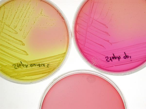 Differenciáló táptalajok Differenciáló táptalaj Sós mannitos táptalaj Staphylococcus aureus mannitot bont sárga telep.