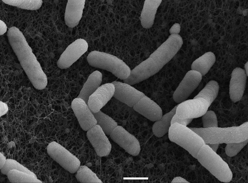Az Escherichia coli O104:H4 járvány humán epidemiológiai és laboratóriumi tapasztalatairól.