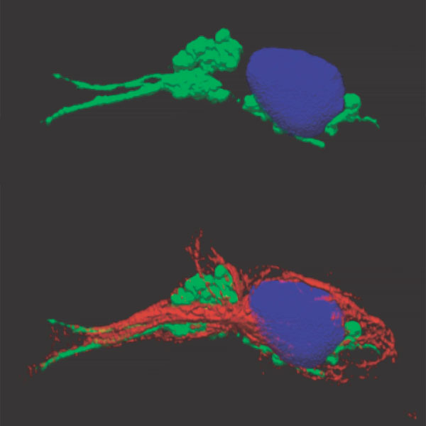 MHCII-eGFP Nucleus Cytoskeleton