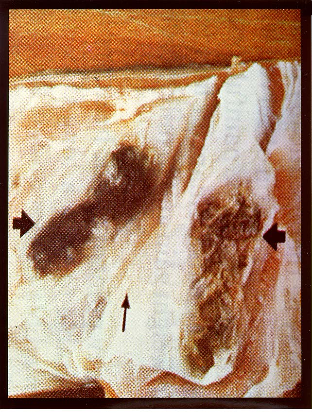 2.kép: sertés izomszövet 10
