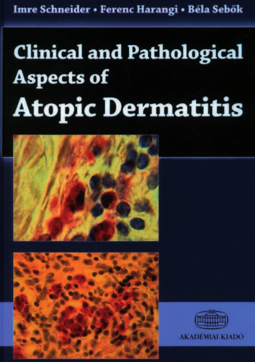 Imre Schneider, Ferenc Harangi, Béla Sebôk: CLINICAL AND PATHOLOGICAL ASPECTS OF ATOPIC DERMATITIS Akadémiai Kiadó 2011 ISBN 978 963 05 9154 6 BÔRGYÓGYÁSZATI ÉS VENEROLÓGIAI SZEMLE 2012 88. ÉVF. 6. 211.