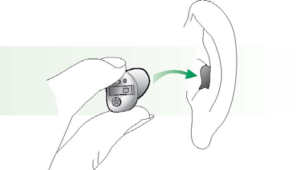 később), mielőtt beteszi a készüléket a fülébe. Így elkerülheti az esetleges sípolást A hallásgondozó szakember kívánságra be is programozhatja a késleltetett bekapcsolást.