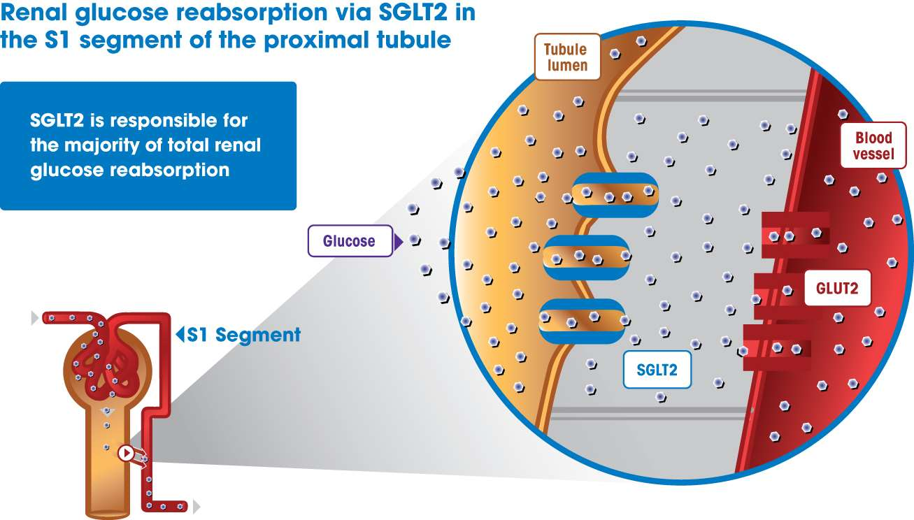 készítmények kezelésére 2 típusú diabetes mellitus maninyl dcont vércukormérő e 6