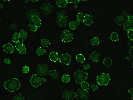 1. ábra. Adhéziók megjelenése 3D migrációs modellben. Zöld: vinkulin az adhéziókban. 2. ábra Boyden kamra membránján átjutó HT1080 fibrosarcoma sejt immunfluoreszcens képe.