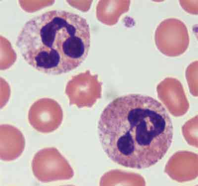 Neutrofil granulocita Arányuk a perifériás vérben: 50-60% A neutrofil granulociták alkotják az gazdaszervezet védekezésének az első vonalát, elsőként ezek a sejtek veszik fel a harcot a kórokozókkal.