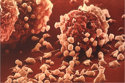 Hízósejtek (angol: mast cells) IgE-t kötő hízósejt Mieloid(?
