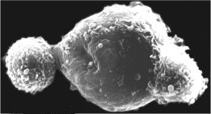 NK sejtek (Natural Killer) NK sejtek elpusztítanak egy tumorsejtet Arányuk a perifériás vérben 10-15% Természetes (innate) immunrendszer részei