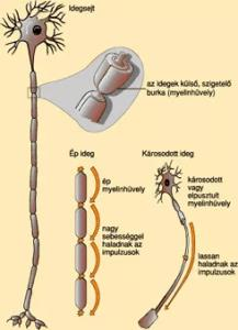 2. ábra A károsodás helye az idegsejtekben Forrás: http://smegyesulet.hu/sm-betegseg/letöltési idő: 2016