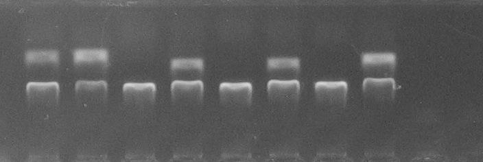 ABO tulajdonsága génszintű vizsgálata (PCR-SSP) Szerológia vizsgálat eredménye 1.