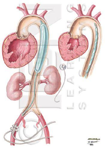 Thrombocyta-szám