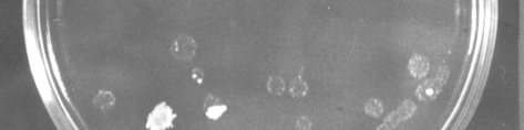 Az 1,5 kb-os fragmentet tartalmazó plazmiddal történő transzformálások során mindig kaptunk transzformáns telepeket, melyek mindegyike mutatta a