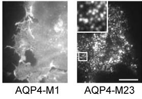 csatornák M23: rövid izoforma -31 kda, nagy OAP, >100 partikulum TIRF images