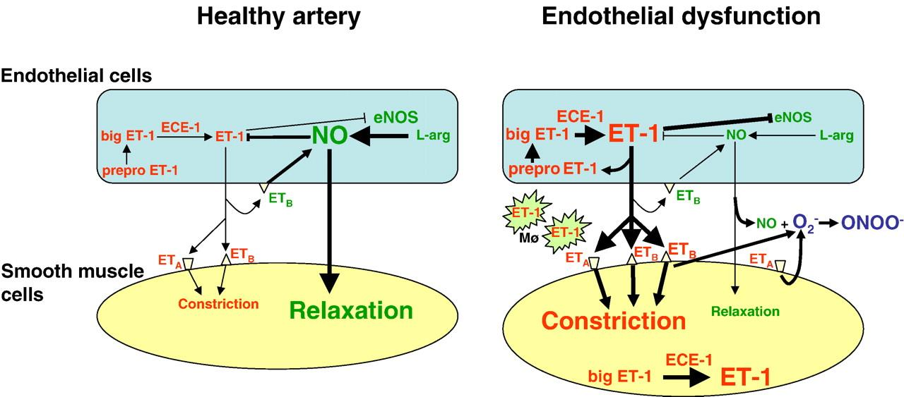 A három ET izopeptid közül az ET-1 a legfontosabb. Schematic figure of the arterial wall under healthy conditions (left) and in endothelial dysfunction (right).