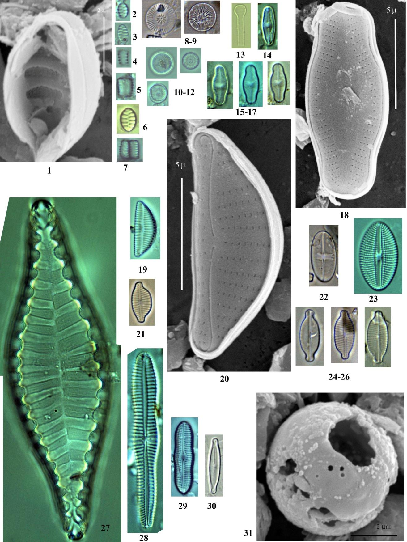 Eredmények 25. ábra A Fogaras hegység mintáira jellemző kovaalgák, 1-7. Staurosirella pinnata 8-9. Cyclotella glomerata 10-12. Cyclotella pseudostelligera 13. Asterionella formosa 14.