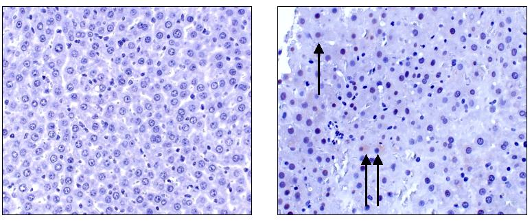 3. Aktív kaszpáz 3 immunhisztokémia Az aktív kaszpáz 3 festés során, a TUNEL reakcióhoz képest kisebb számban voltak találhatóak pozitív festődésű sejtek,