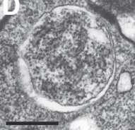 késői endoszóma lizoszóma izoláló membrán Autofagoszóma Autofagolizoszóma 7. Ábra. Makroautofágia. A rajz a makroautofág folyamat főbb lépéseit mutatja.