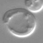 A jobb oldali képen felül egy élesztő vakuóla (nyíl) (a lizoszómának megfelelő sejtszervecske; fénymikroszkópos felvétel), alul egy C.