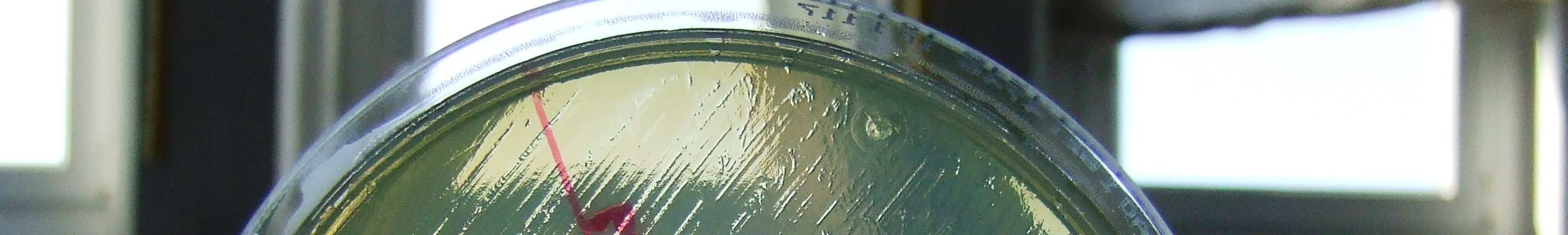 tartalmú nanohibridekkel Bacillus