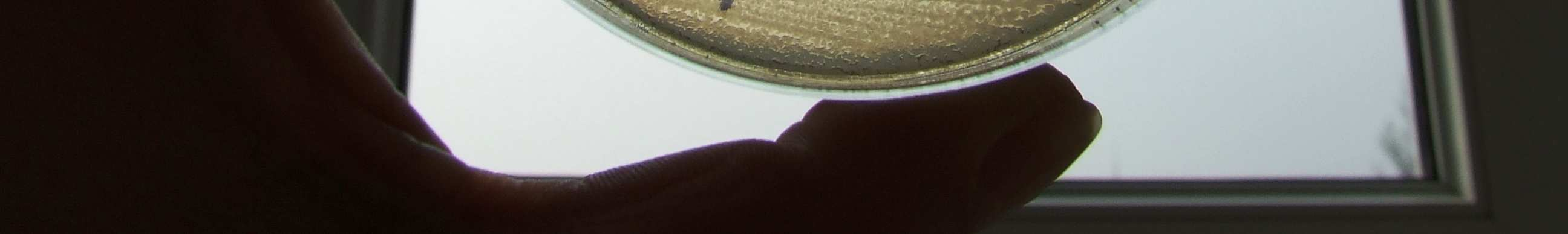 Az Aspergillus niger fonalas gomba