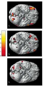 somatic marker hypothesis [4], feedback from the autonomic, musculoskeletal, and endocrine systems to cortical areas is critical for emotional responding.