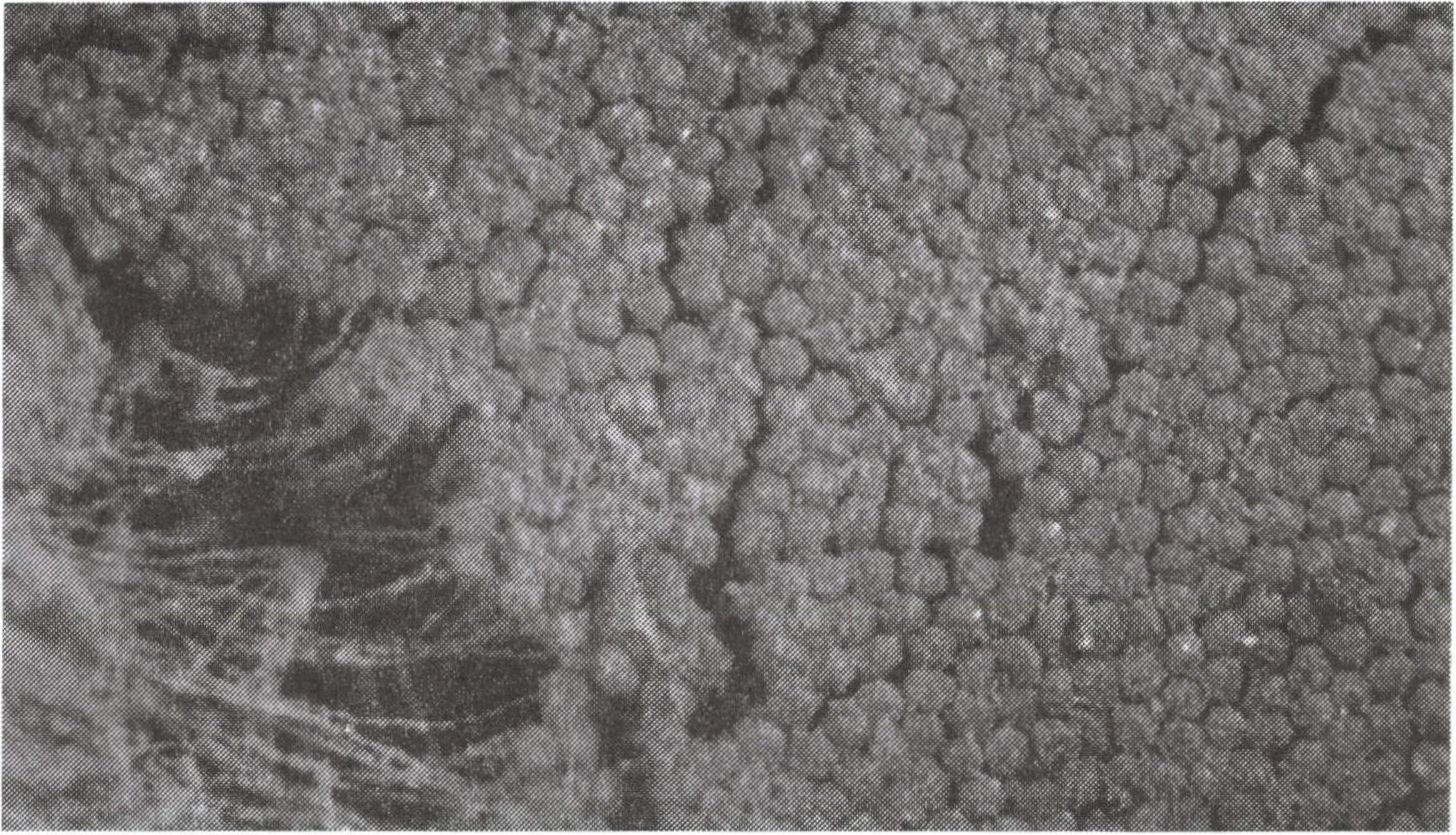 41 5. ábra Dictydiaethalium plumbeum pseudoetaliumának részlete A nyálkagombák hat rendje és osztályaik BÁNHEGYI-TÓTH-UBRIZSY- VÖRÖS Magyarország mikroszkopikus gombáinak határozókönyve szerint a