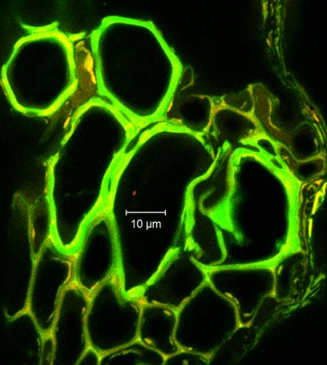 monocytogenes CCM 4699-cel beoltott növények szöveteiből sem sikerült egyetlen esetben sem baktérium sejtet detektálni, amit a 31.