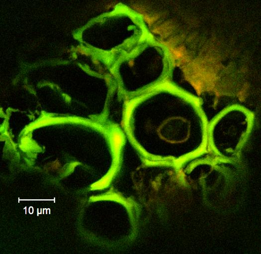 Listeria, esetleg Escherichia vagy Shigella fajok, amelyekkel a specifikus próbák