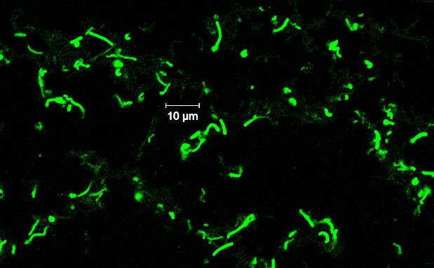 Az Escherichia és Listeria fajok kimutatására használt oligonukleotid próbák