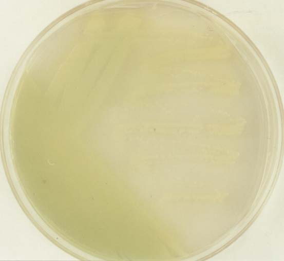 11. Pseudomonas aeruginosa on agar and blood agar plate Pseudomonas aeruginosa agar lemezen 2-3 mm átmérõjû telepek.
