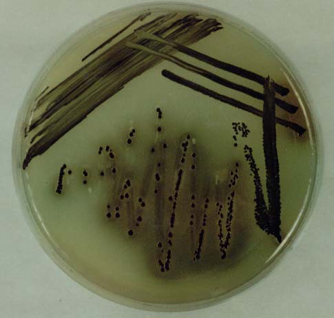 13. Salmonella sp. on bismuth-sulphite medium Salmonella typhi bizmutszulfit táptalajon A táptalaj brillantzöldet, valamint Bi- és Na-szulfitot tartalmaz.