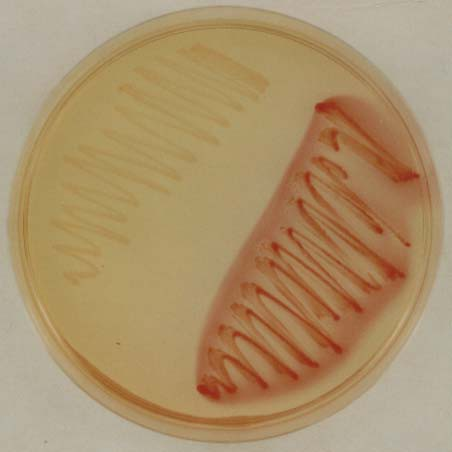 15. E. coli and Shigella sp. on DC medium Shigella és E.