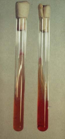 17. Russel medium(steril) and: (a) lactose +, gas + (b) lactose -, gas + (c) lactose -, gas Russel táptalaj szénhidrát fermentáció kimutatására