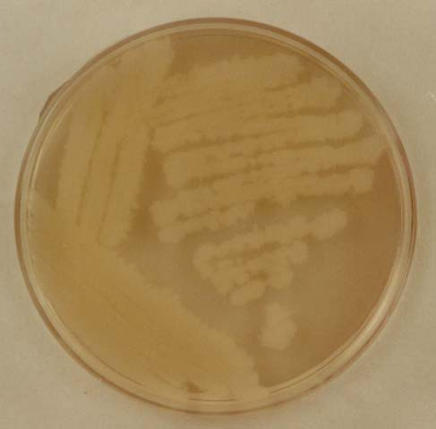 22. Bacillus cereus on agar and blood agar plate medium Bacillus cereus agar táptalajon