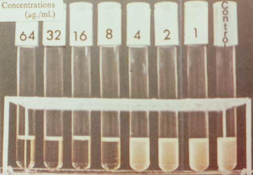 2. Widal's type tube agglutination tests: (a) Gruber-Widal reakció (b) Weil-Felix reakció (c) Wright reakció (d) Paul-Bunnel reakció Csõ-agglutináció (kvantitatív agglutináció) Gruber-Widál