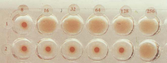 Hemagglutináció gátlás (HAG) Komplement kötési reakció (KKR) 5.