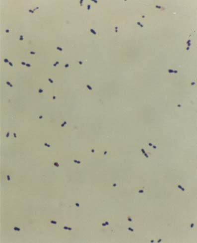 - S. pneumoniae Streptococcus pneumoniae -
