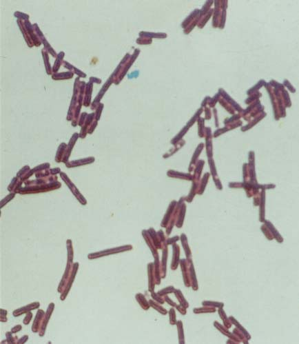 - Bacillus cereus Bacillus cereus - Gram festés Gram + pálcák, centrálisan nem deformáló
