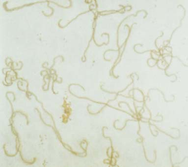 3. Silver impregnation: Leptospira sp.