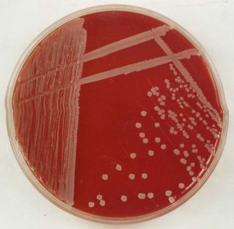 3. S. epidermidis on blood agar plate Staphylococcus epidermidis véresagar táptalajon 1-2