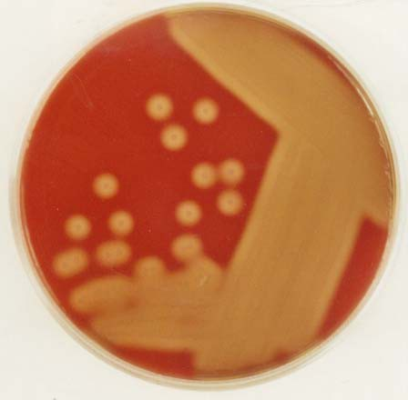 5. Streptococcus pyogenes on blood agar plate Streptococcus pyogenes véresagar