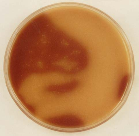 7. S. pneumoniae on blood and on chocolate agar plate Streptococcus pneumoniae véresagar táptalajon 1-2 mm átmérõjû, sima felszínû telepek, közepükön köldökszerû behúzódás A telepeket alfa-típusú