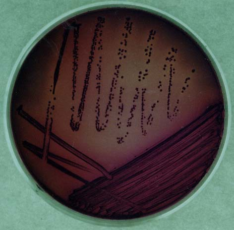 9. Escherichia coli on agar and on eosin-methyleneblue medium Escherichia coli Eozin