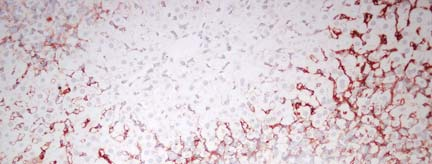 Abból a célból, hogy megvizsgáljuk a matrilin-2 expresszója hogyan követi a laminin expresszióját, párhuzamos metszeteken minden esetben laminin immunreakciót is végeztünk.