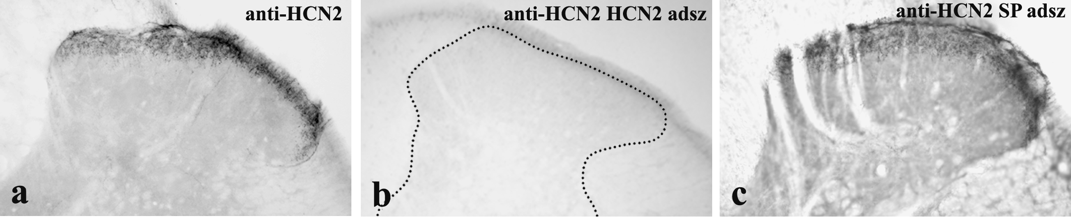 30 A HCN2 és a P-anyag (SP) immunreaktivitásának nagymértékű kolokalizációja felvetette a primer antitestek keresztreakciójának kérdését, ezért néhány metszeten úgy teszteltük az antitestek