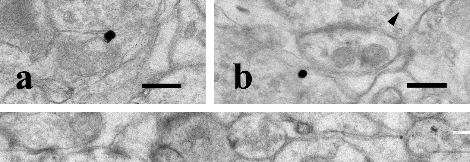 Az immunreaktív axonterminálisok szinte mindegyikében, a szinaptikus vezikulák között elszórtan dense core vezikulákat is találtunk, amelyek a peptiderg axonvégződésekre jellemzőek.