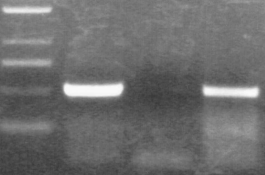 nsoa LSHO2 nsob nsoc nsod LSHO37 LSHO1 M gk RT- RT+ 1000 bp 750 bp 500 bp 250 bp 7. ábra A T. litoralis nso gének transzkripcionális szerveződésének vizsgálata RT-PCR-rel.