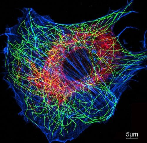 Neuronok és a Glia sejtek cytoskeletonja Microtubulusok (Tubulin)- Strukturális elemek:tubulinok, MAPs Mozgató rendszer: Kinesinek ésdyneinek Microfilamentumok (Actin)- Strukturális elemek: Actin,