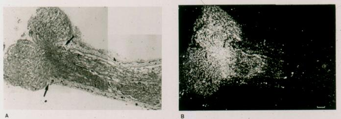 Átvágott idegvég * Radioactive nerve growth factor Macrophag: debris takarítás, mitogen szignálok (Schwann sejtek) Schwann sejtek (permisszív