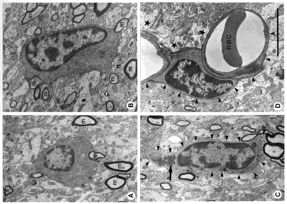 Oligodendroglia sejtek elektronmikroszkópos képe